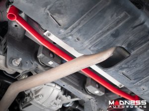 Alfa Romeo Giulia Suspension Upgrade Kit - 3 Piece Set - AWD Alfa Romeo Giulia Suspension Upgrade Kit - 3 Piece Set - AWD